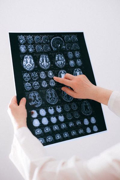 diagnostico